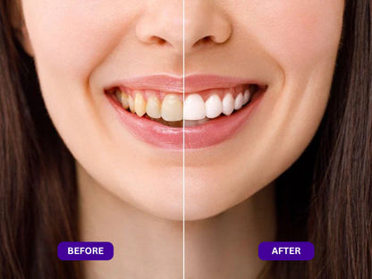 Slimifyfit™ Purple Mouth Wash