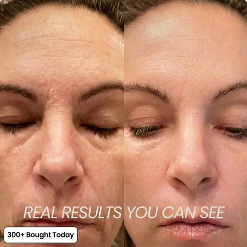 PDRN Pink Collagen Volume Multi Balm