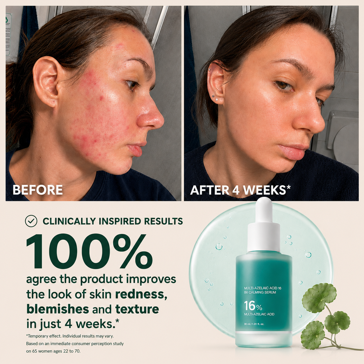 Slimifyfit Anchoic Acid Soothing Serum