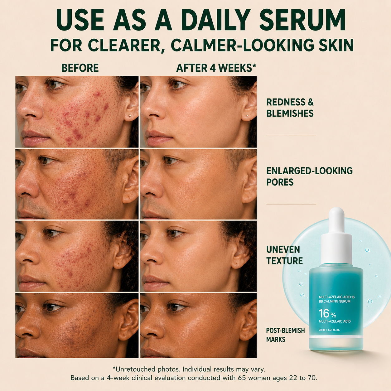 Slimifyfit Anchoic Acid Soothing Serum