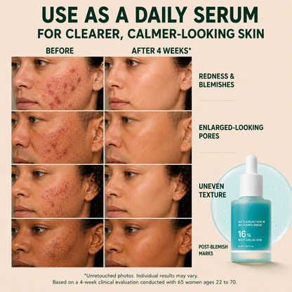 Slimifyfit Anchoic Acid Soothing Serum