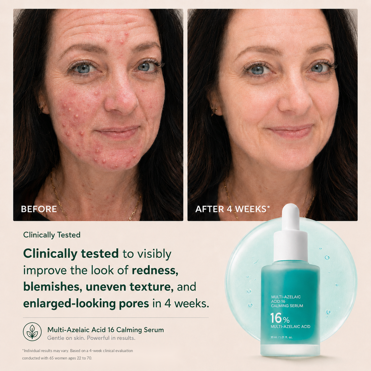 Slimifyfit Anchoic Acid Soothing Serum