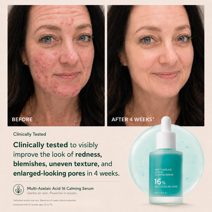 Slimifyfit Anchoic Acid Soothing Serum